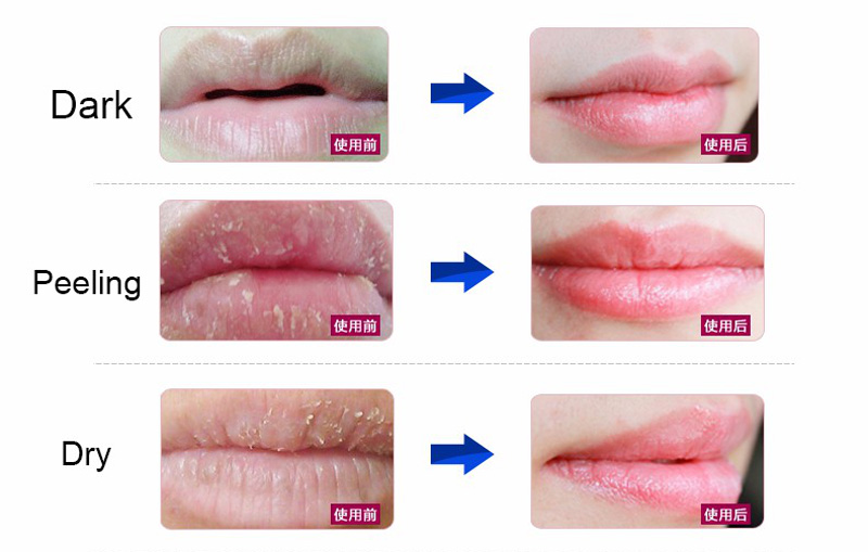 Calla-Korean Best Gold Collagen Crystal Lip Mask | Best Hydrating Lip Mask-5
