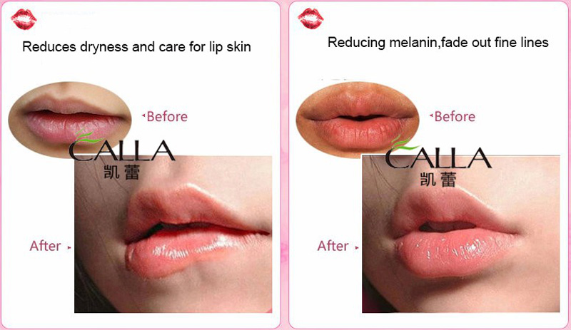Calla-Korean Best Gold Collagen Crystal Lip Mask | Best Hydrating Lip Mask-6