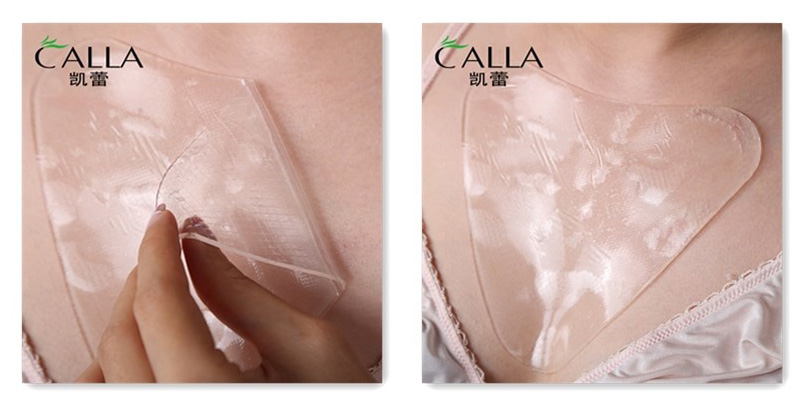 Calla-Find Silicone Pad Scar Treatment best Anti Scar Cream On Calla-2
