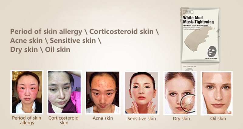 Calla-Find Wholesale Skin Care Manufacturers Best Face Masks On The Market From-4
