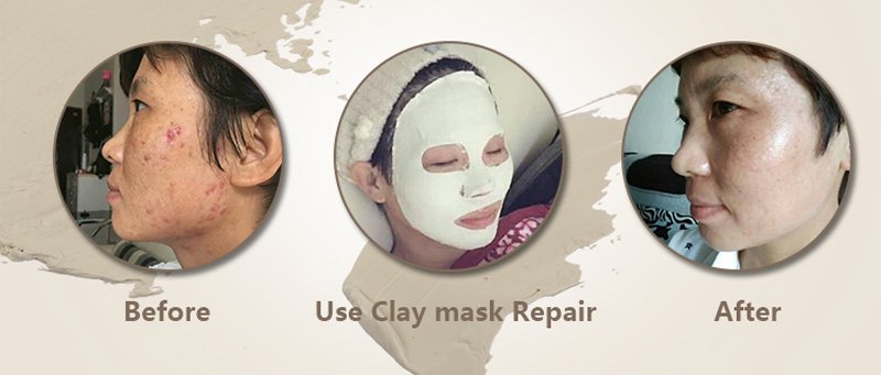 Calla-Find White Clay Mud Mask Sheet Wcfm010 | Manufacture-5