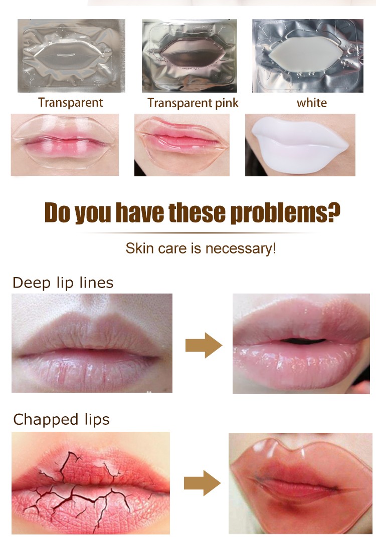 Calla-Oem Lip Mask For Dry Lips Manufacturer, Best Lip Treatment For Fine Lines-1