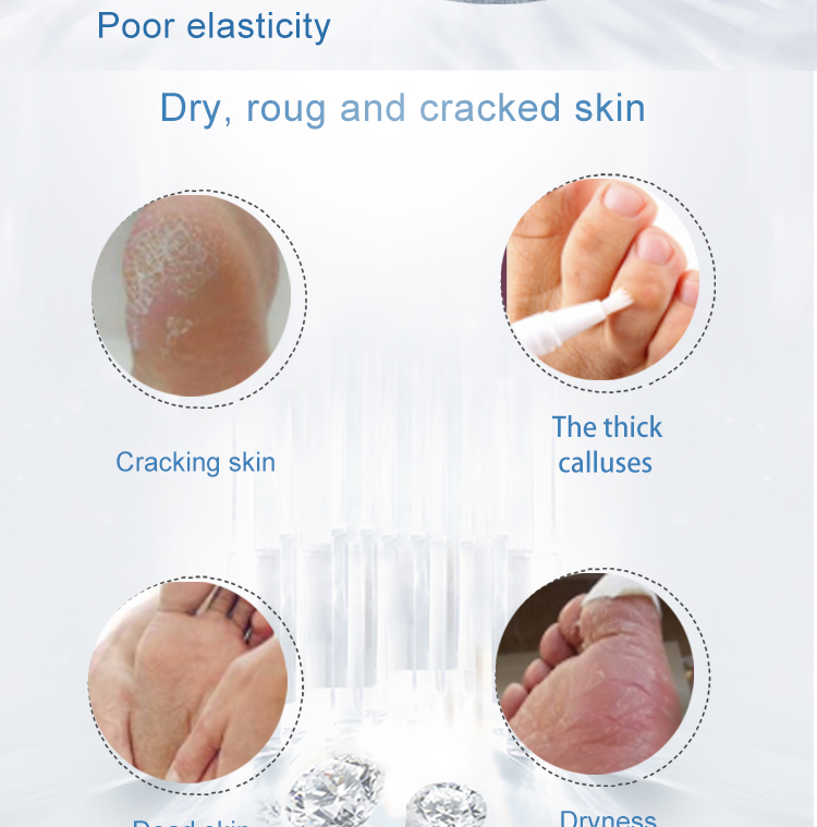 product-SPA deep moisturizing wax foot mask-Calla-img