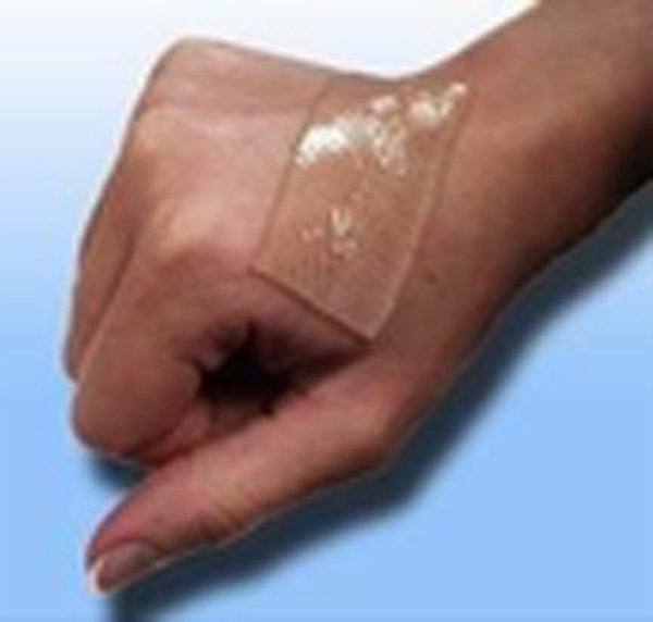 Calla-Find Where To Buy Silicone Strips For Scars surgery Scar Healing-4