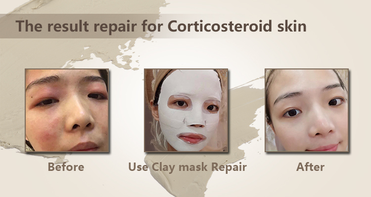 Calla-Before using skin care products, your basic skills are not good enough | News On Calla Skin Ca-4