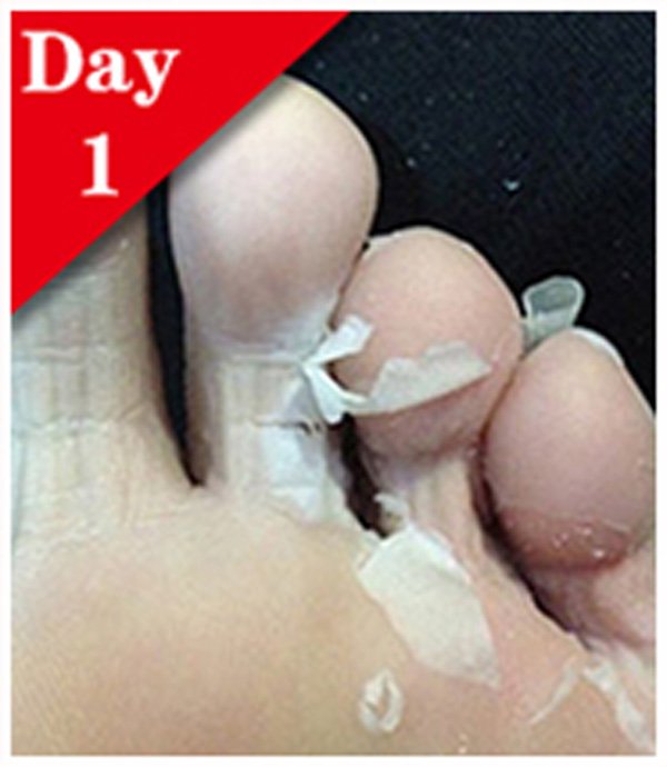 Calla-Fda Gmpc Wholesale Peel Off Callu Remover Soft Foot Sock - Calla Skin Care-3