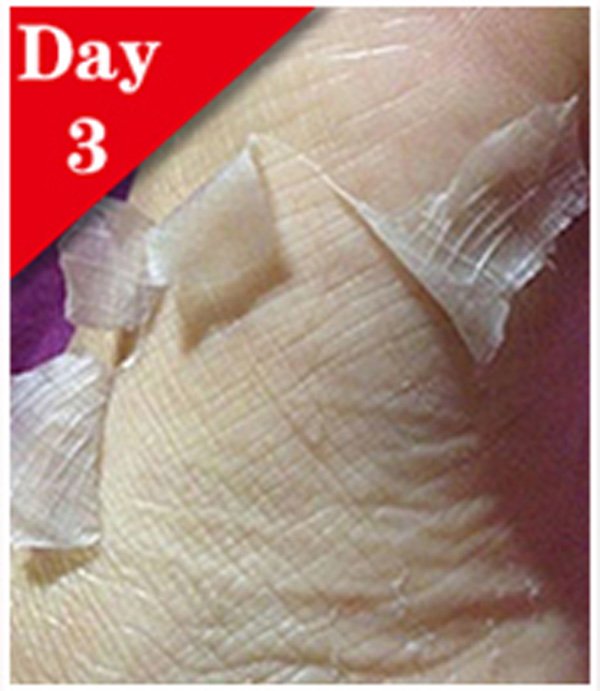 Calla-Fda Gmpc Wholesale Peel Off Callu Remover Soft Foot Sock - Calla Skin Care-4