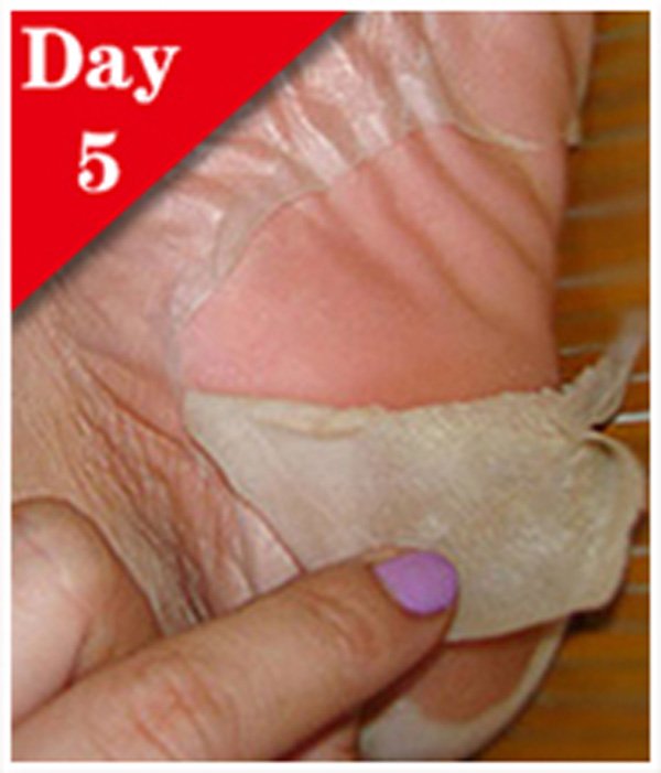 Calla-Fda Gmpc Wholesale Peel Off Callu Remover Soft Foot Sock - Calla Skin Care-5