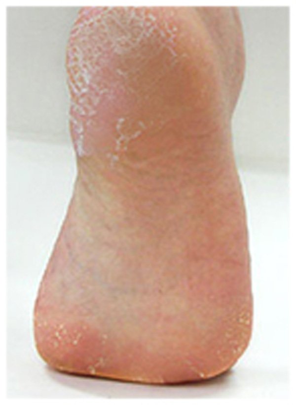 Calla-Good Price Exfoliate Callu Peeling Foot Mask Exfoliating Sock | Foot Hand-6
