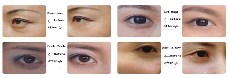 Calla-Anti-aging Hyaluronic Acid Eyes Mask Golden Crystal Collagen Eye Pad |-2