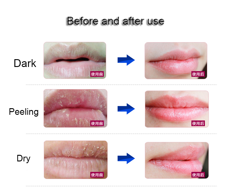 Calla-The Method Of Lip Skin Care | News-3