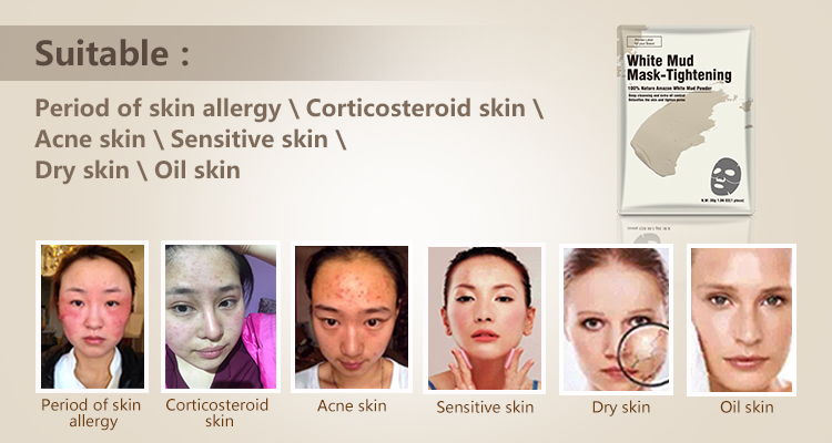 Calla-Skin Care Recipe: Prevent Sensitive Skin Redness In Autumn And Winter News-3
