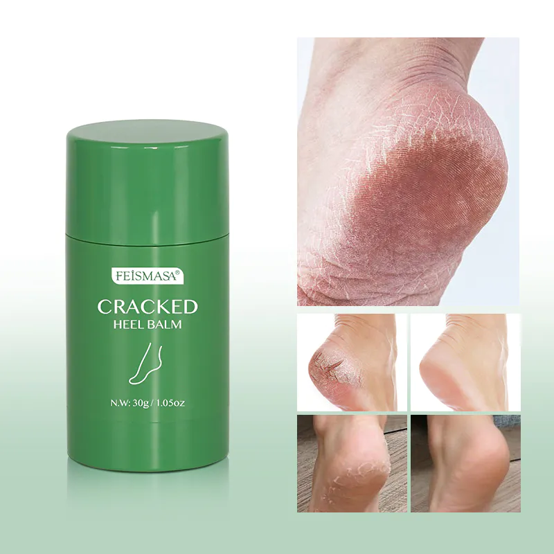 Smooth Feet, Happy Feet: Moisturizing Foot Crack Balm for Soft and Healthy Skin
