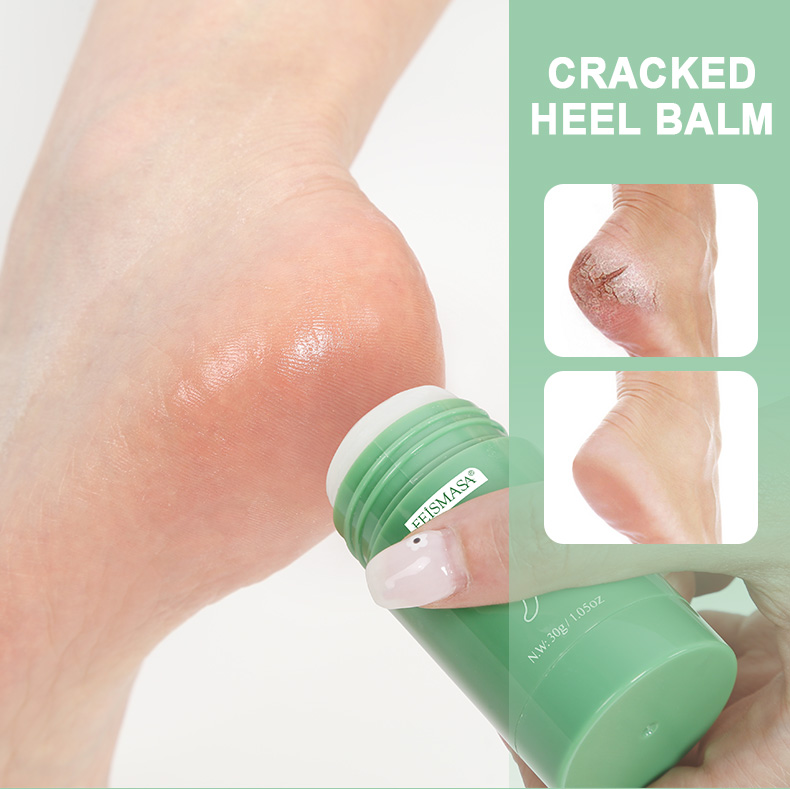 product-Smooth Feet, Happy Feet: Moisturizing Foot Crack Balm for Soft and Healthy Skin-Calla-img