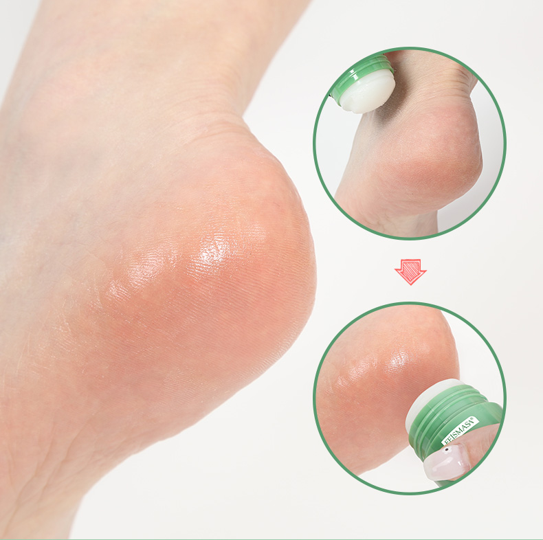 product-Calla-Smooth Feet, Happy Feet: Moisturizing Foot Crack Balm for Soft and Healthy Skin-img