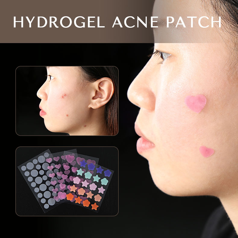news-Calla-Acne Patches: An Effective Solution for Blemishes-img