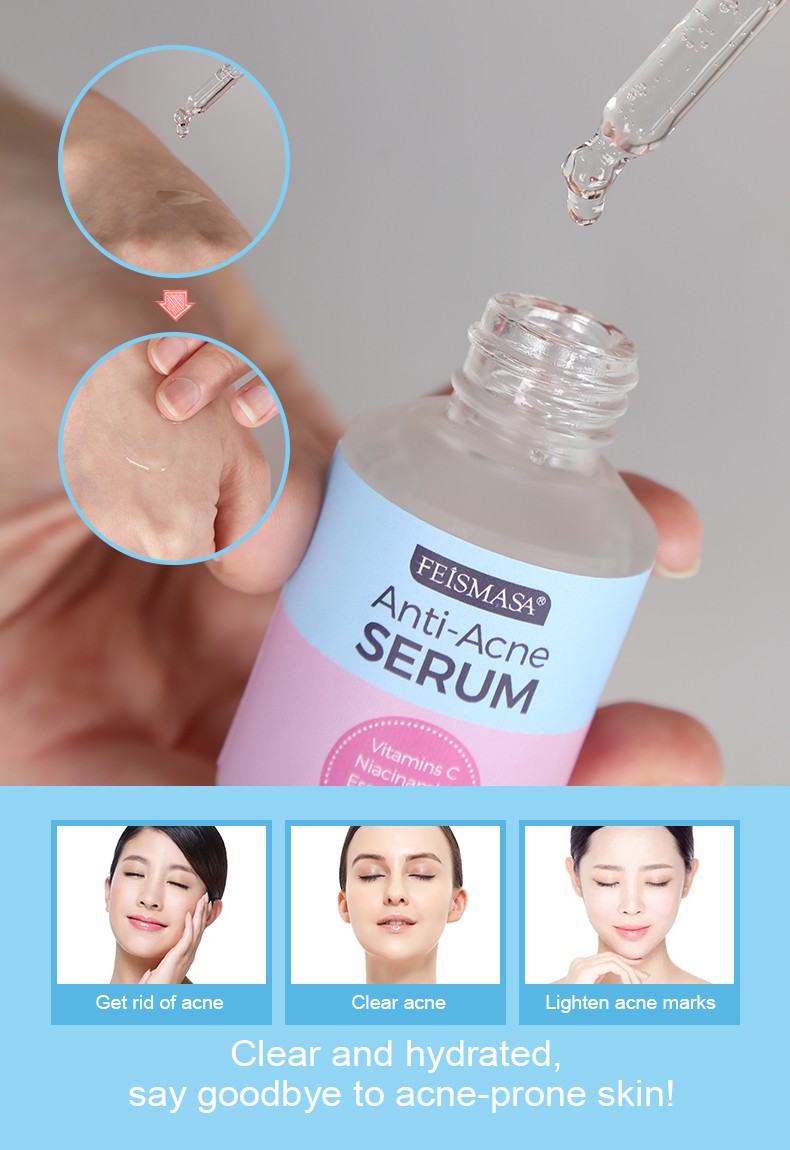 product-Calla-Anti-Acne Serum-img