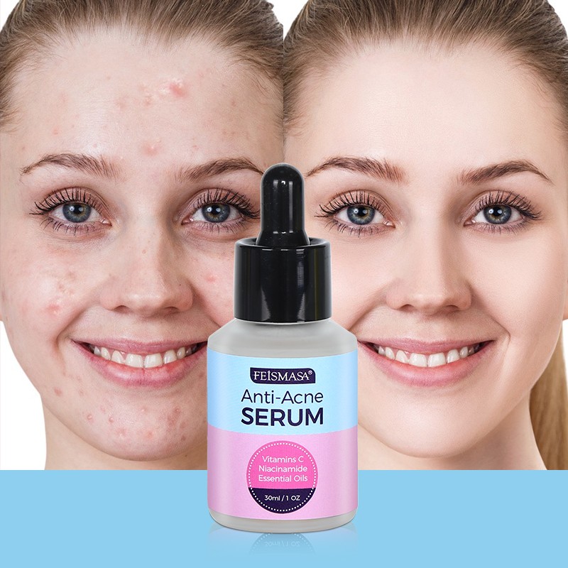 news-Vitamin A Skin Care Serum Dark Spot Remover For Face Vitamin C Face Anti Acne Serum-Calla-img-2