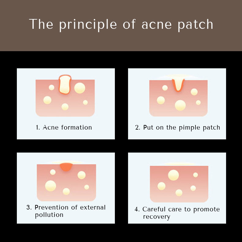 news-hydrocolloid acne star pimple patch custom-Calla-img-1