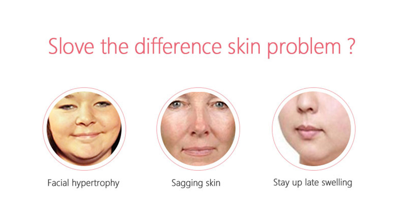 news-Lift Mask: The secret to your V-face-Calla-img