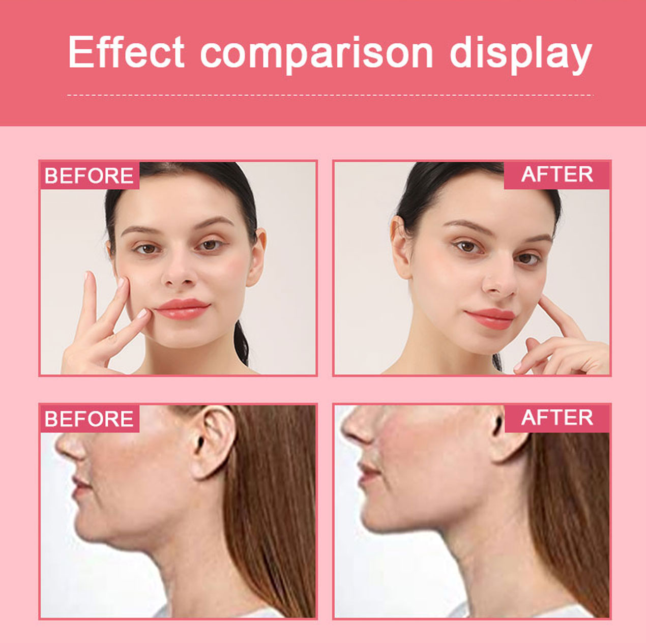 news-Calla-Lift Mask: The secret to your V-face-img-2