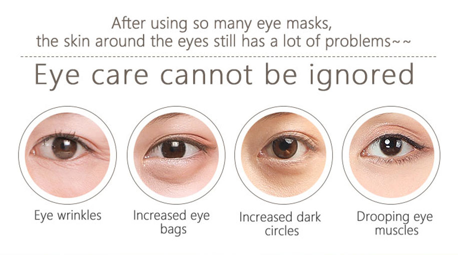 product-Calla-img