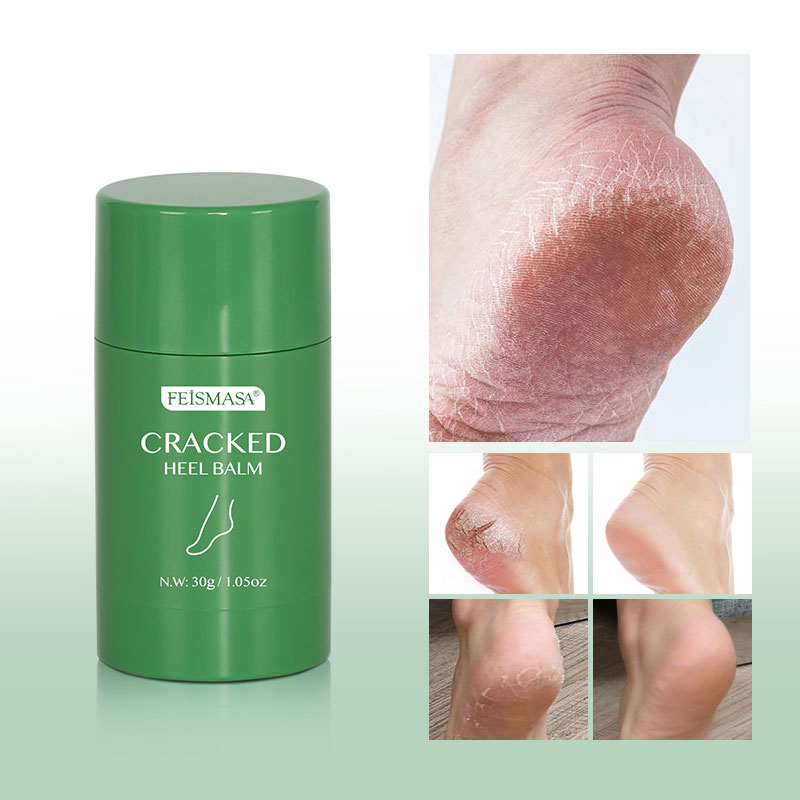 Moisturising Cracked Heels Balm Repair Exfoliating Anti Crack Peeling Dead Skin Removal Foot Cream