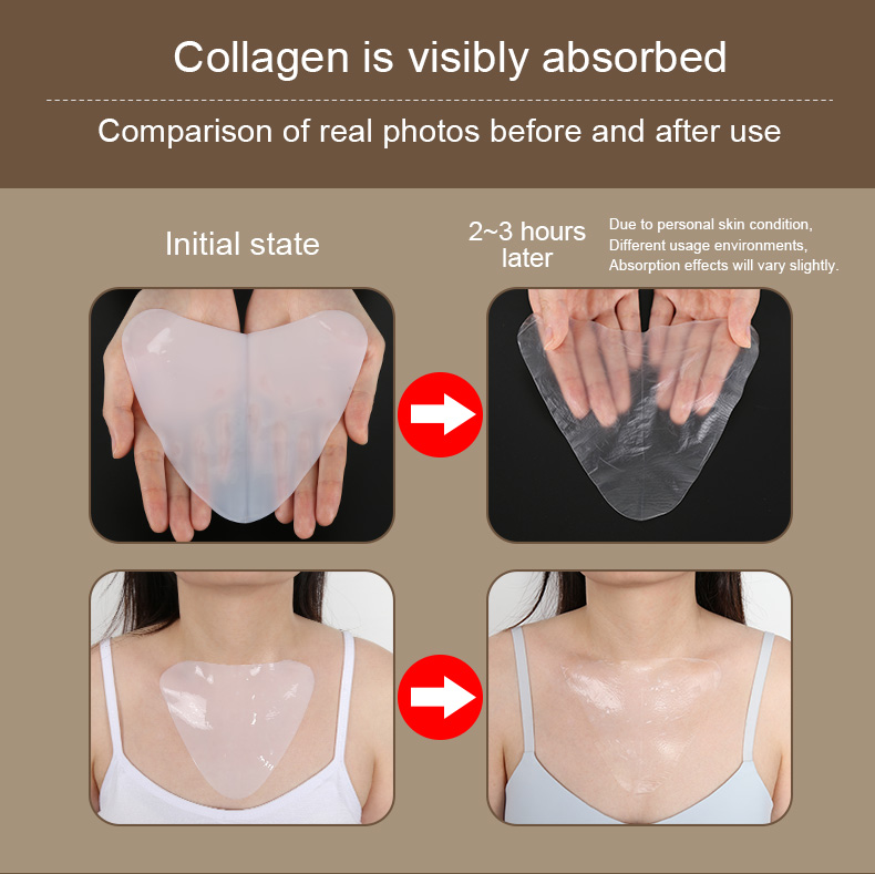 Collagen Absorbable Chest Mask