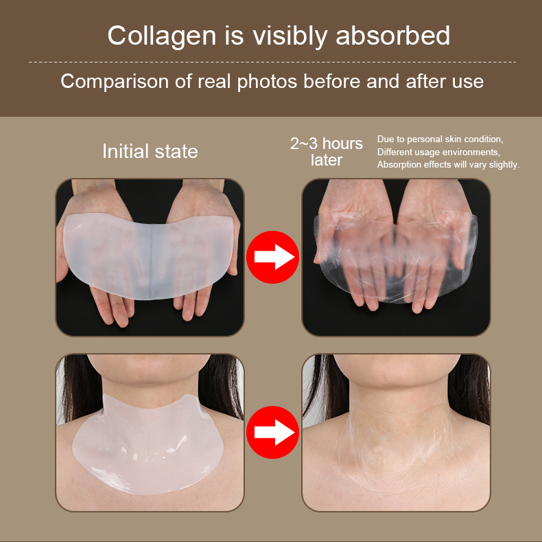 news-Collagen neck membrane, to raise the swan neck-Calla-img