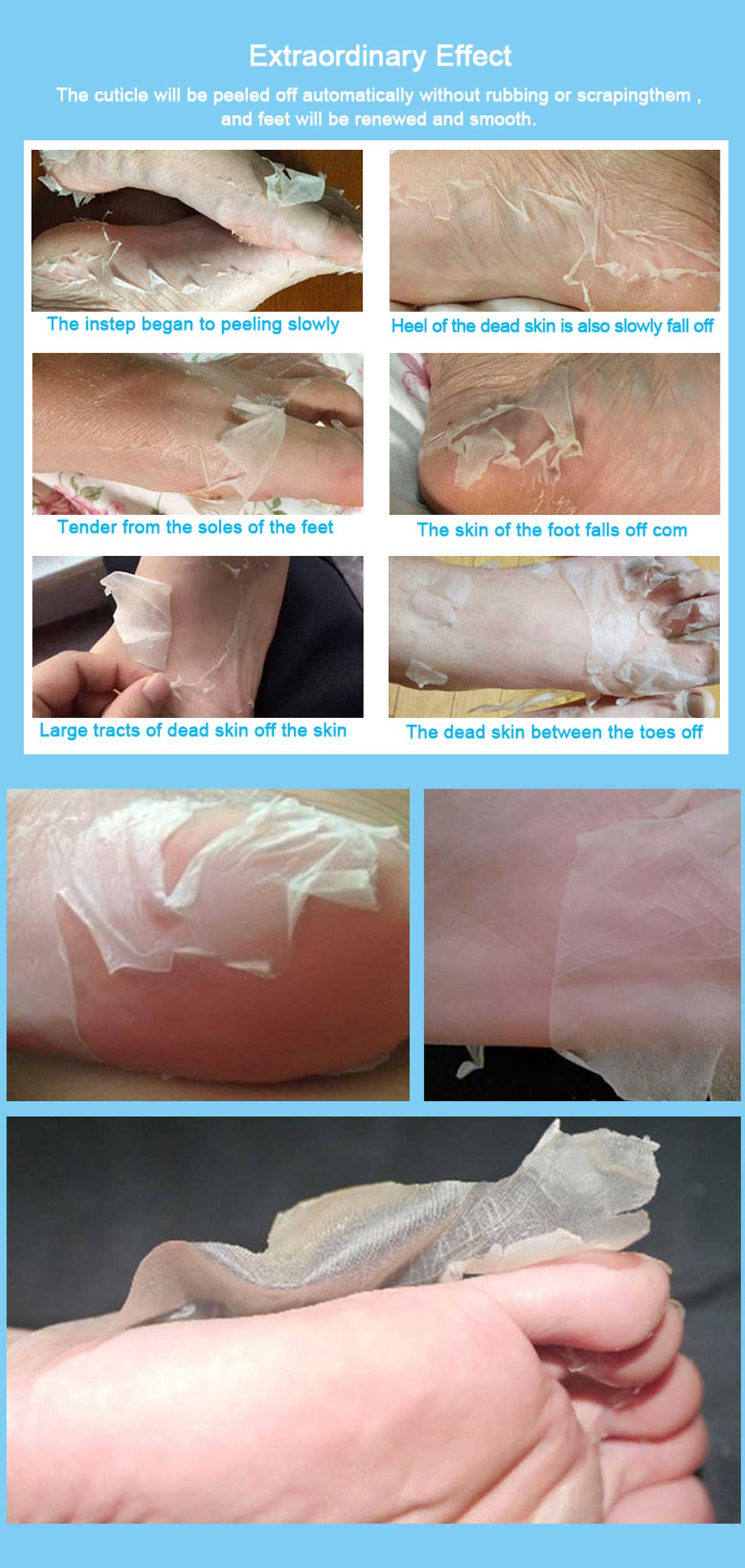 news-Calla-Why use a peeling foot mask and how does it work-img-1