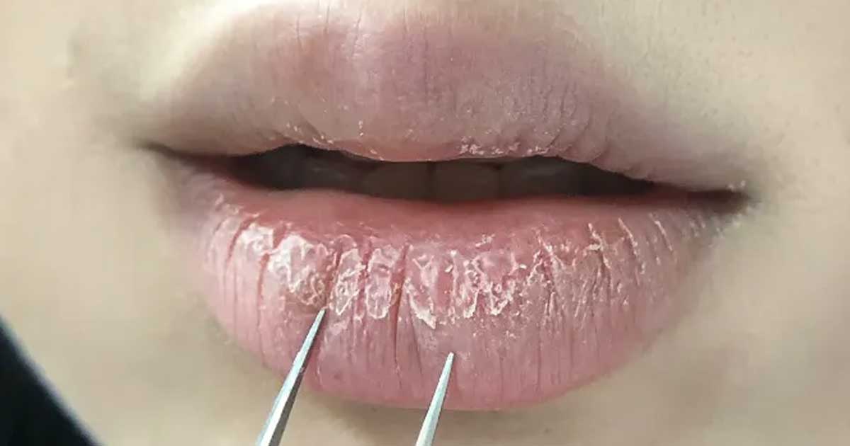 lip mask