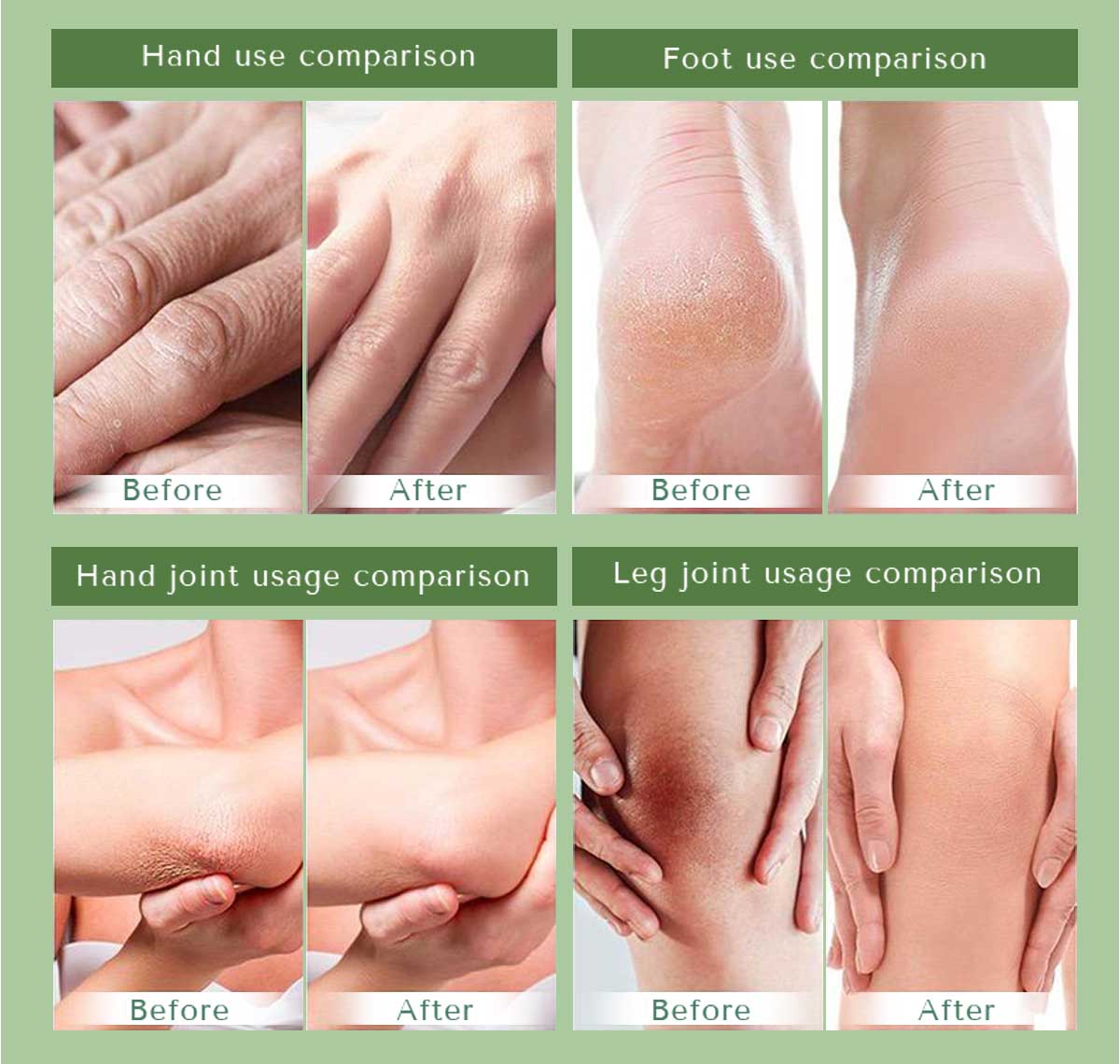 Moisturizing Hand & Foot Cream