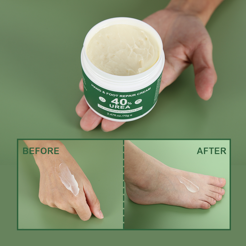 custom logo Allantoin Moisturizing Hand & Foot Cream