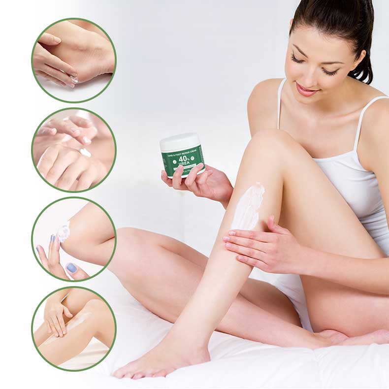 product-Calla-img