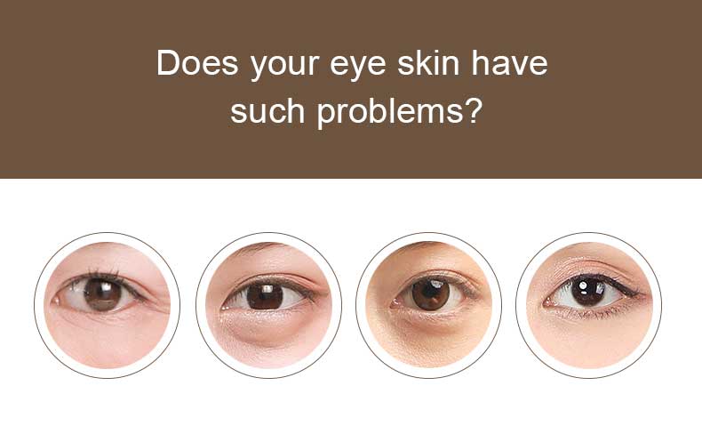 product-Calla-Moisturizing Nourishment Collagen Absorbable Gel Eye Patch Under Eye Mask-img