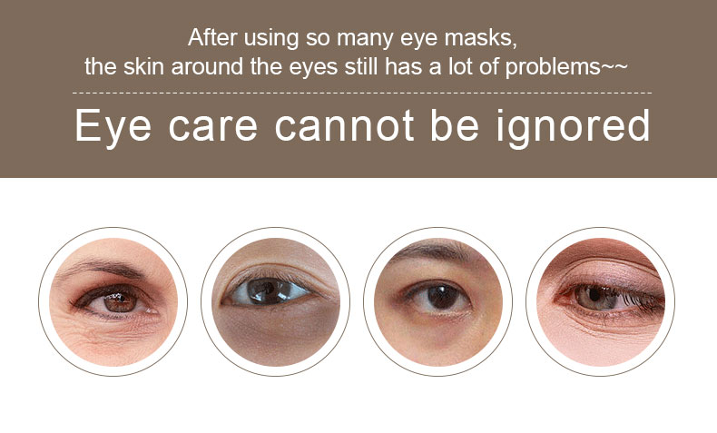 product-Calla-img