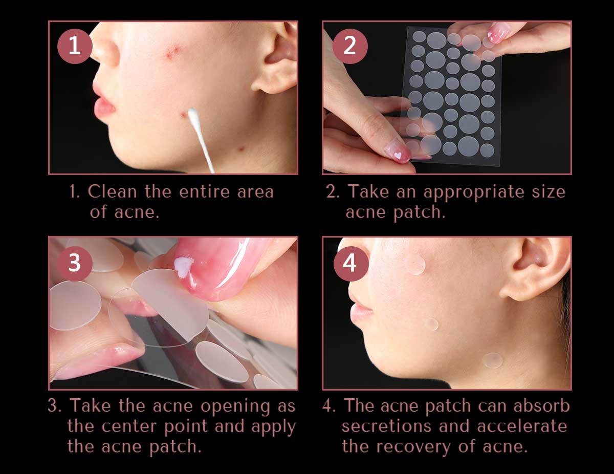 acne pimple patch
