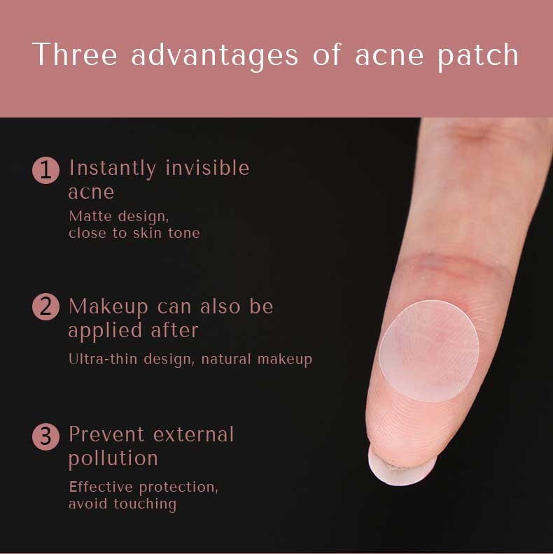 product-Calla-Customizable Hydrocolloid Stock Pimple Patch Acne Patches Vegan Acne Products For Face-1