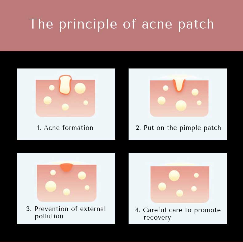 product-Customizable Hydrocolloid Stock Pimple Patch Acne Patches Vegan Acne Products For Face-Calla-1