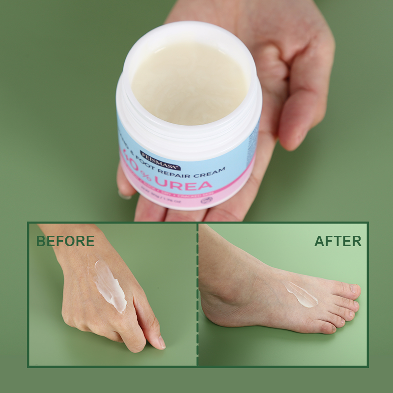 Hyaluronic Acid Foot Cream For Adults Dead Skin Whitening Moisturizing Exfoliation Softening Foot Cream Wholesale