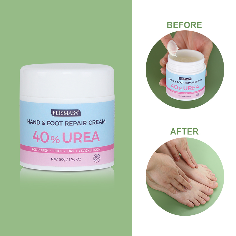 Hyaluronic Acid Foot Cream For Adults Dead Skin Whitening Moisturizing Exfoliation Softening Foot Cream Wholesale