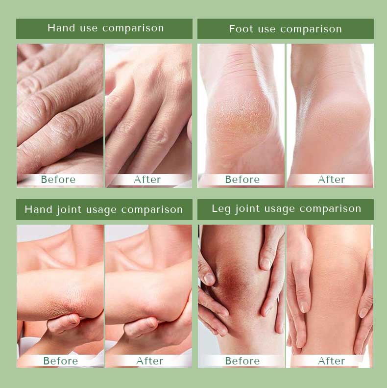 hand foot cream