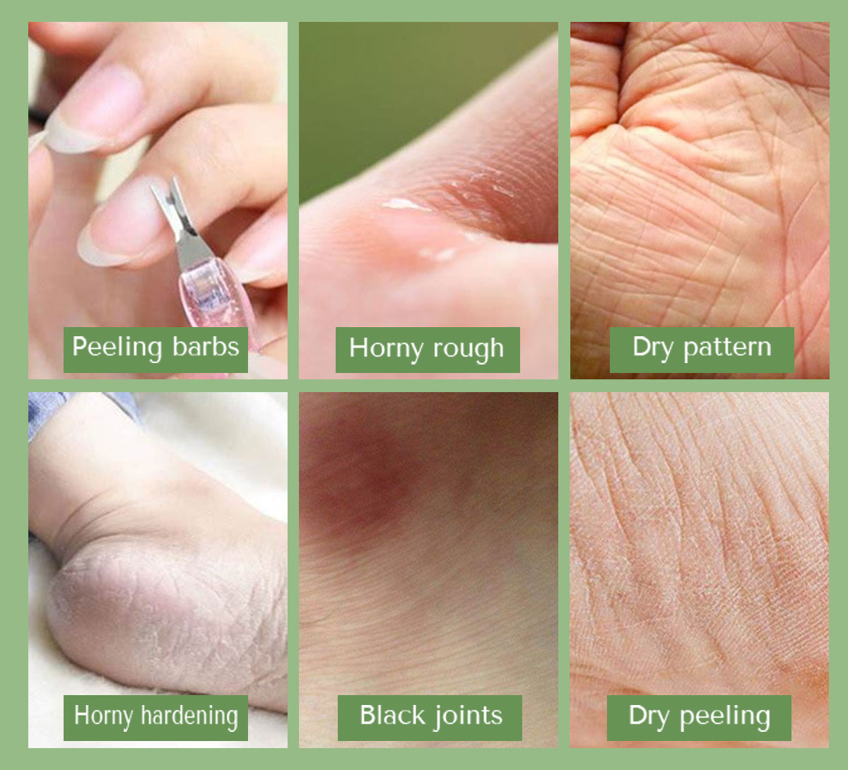 news-Calla-Hand and foot cream, apply it to hands and feet for 7 days, dry lines, calluses, and crac
