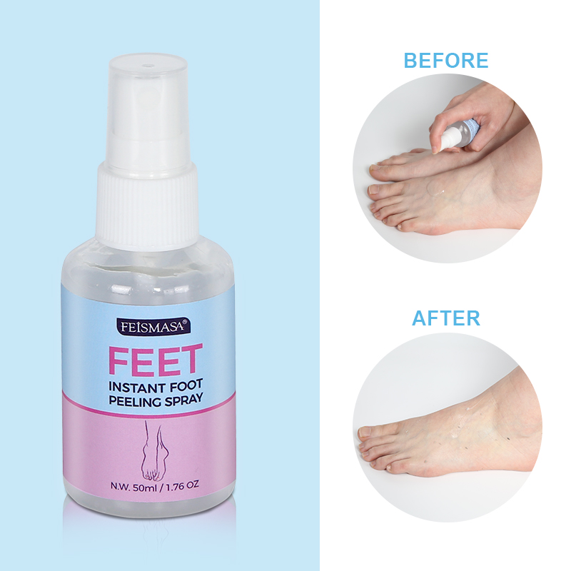 Feet instant foot peeling spray