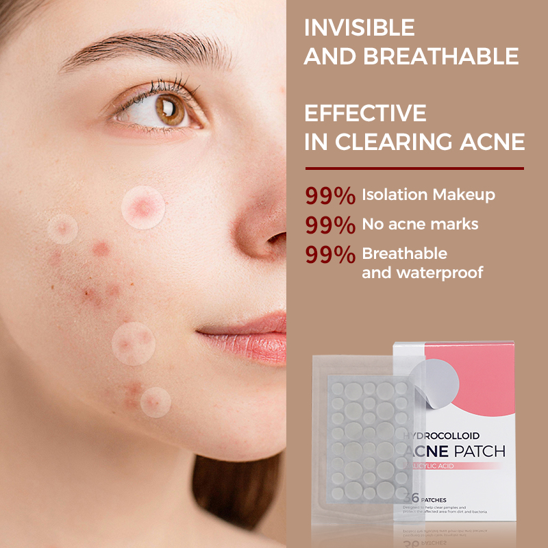 hydrocolloid patches for acne dots for spots acne patches
