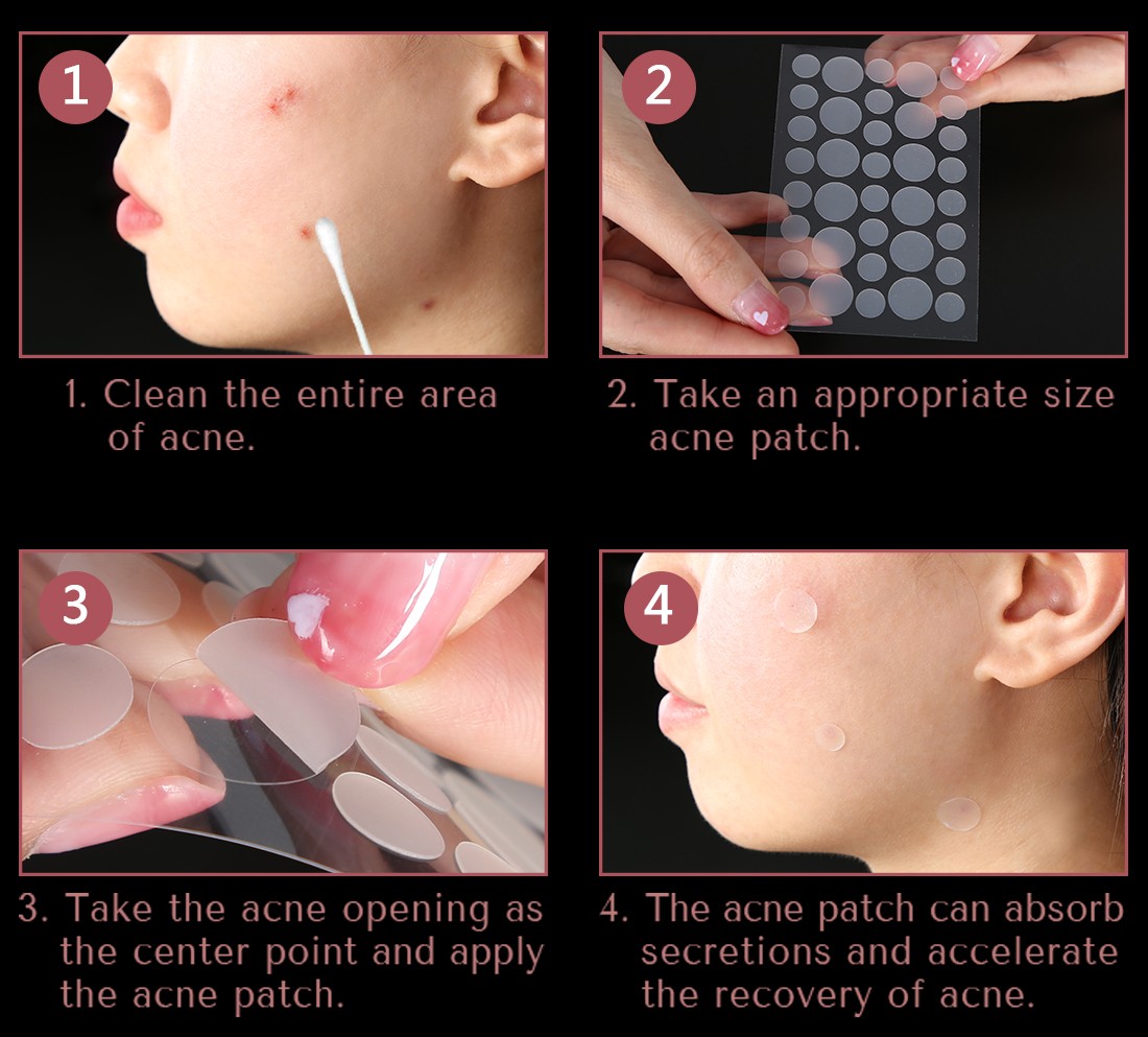 pimple patch